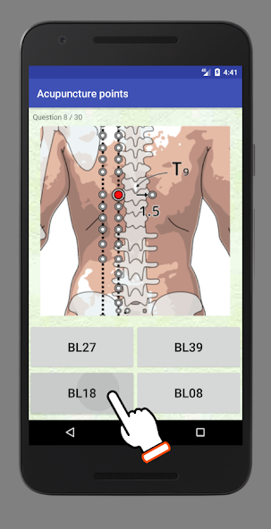 acupuncturepoint trial