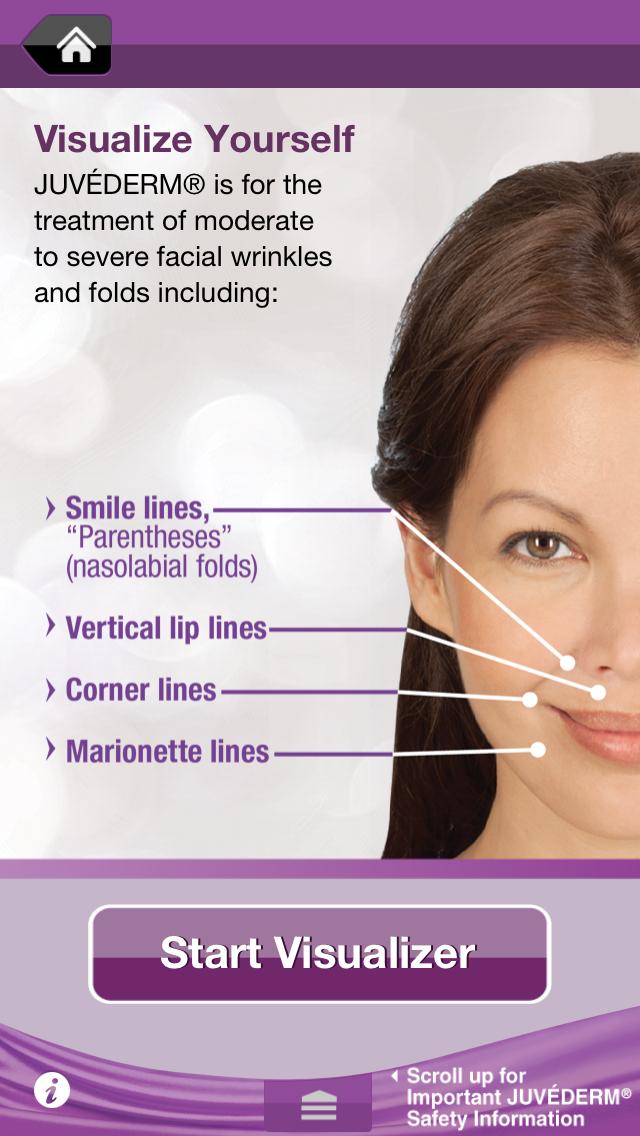 JUVEDERM Treatment Visualizer
