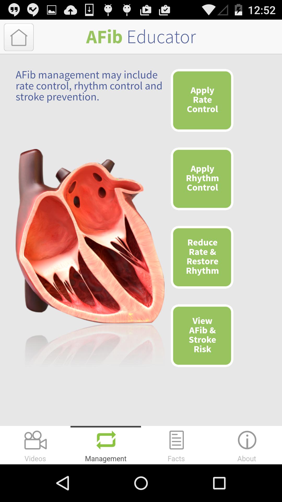 AFib Educator