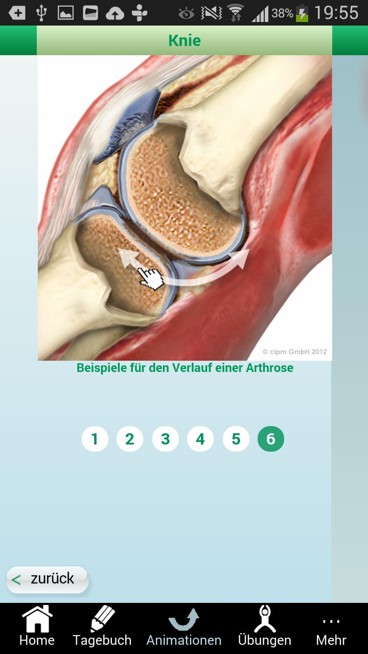 Arthrose-Tagebuch
