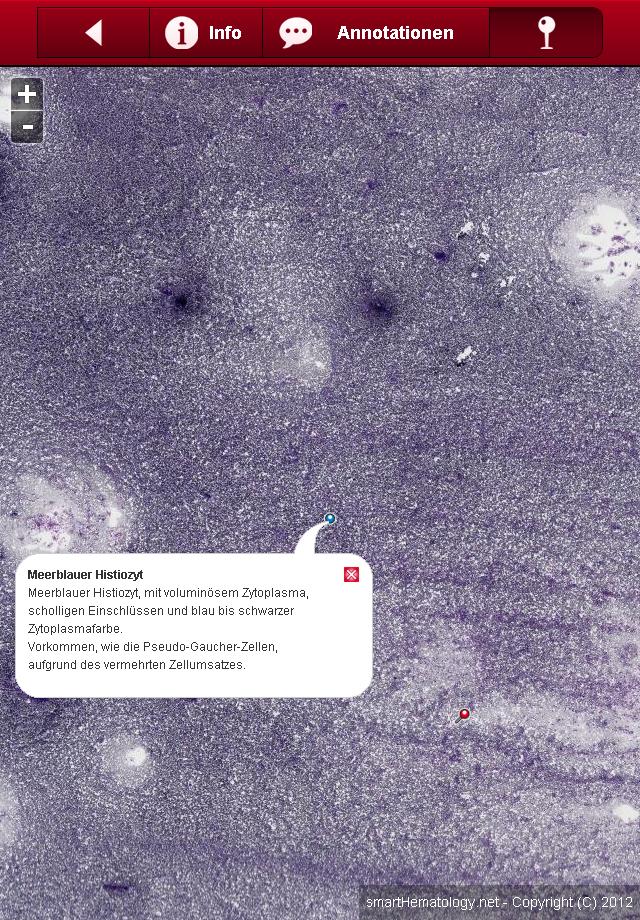 Smart Hematology Lite