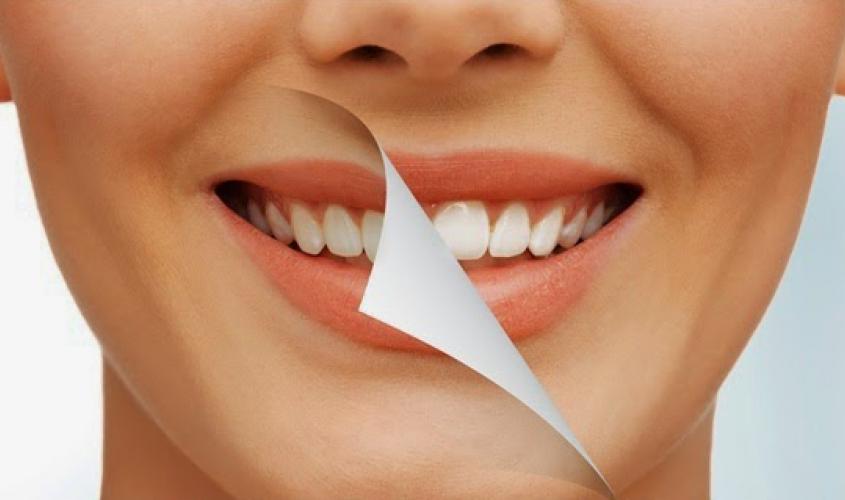 Tips Cara Memutihkan Gigi