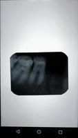 Dental X-Ray Viewer