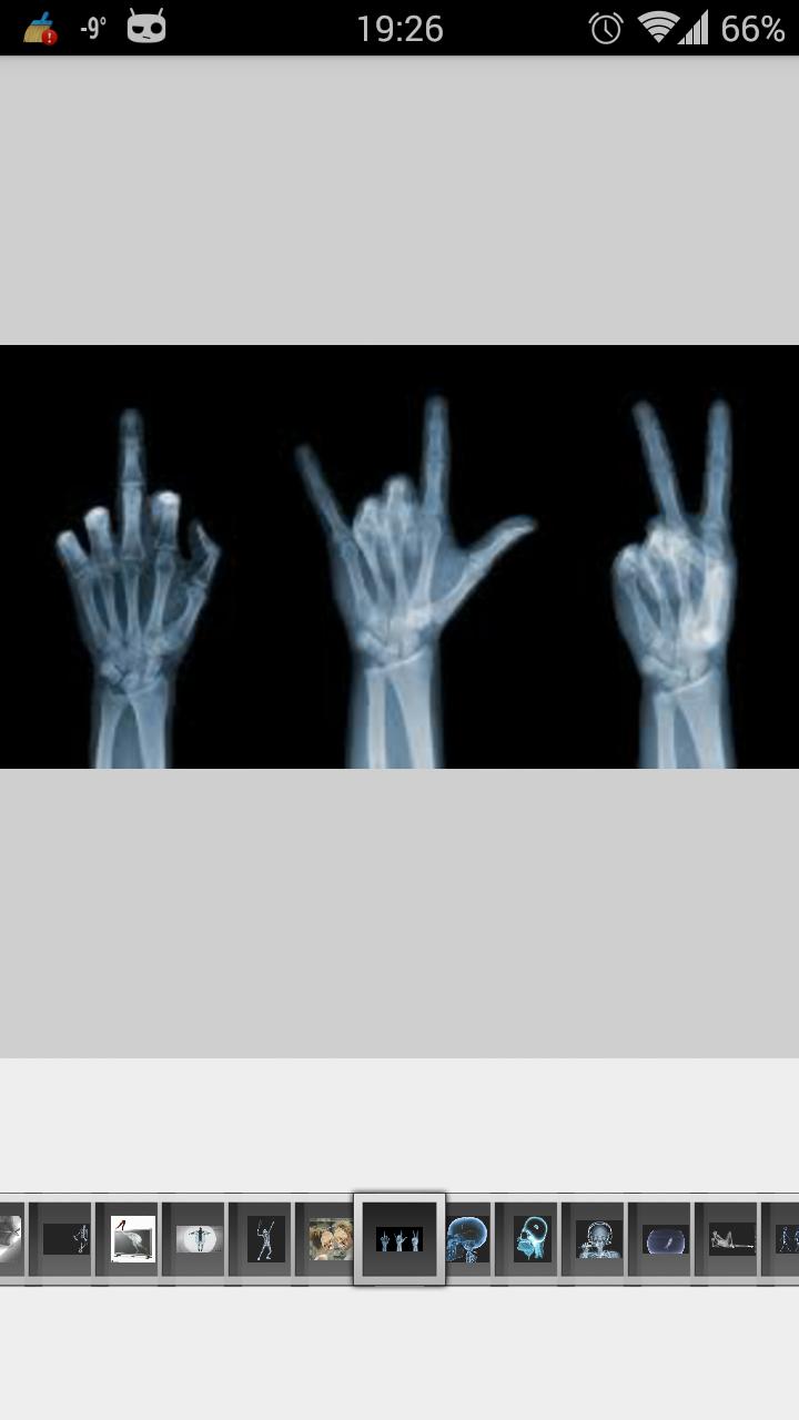Super Funny X-Ray