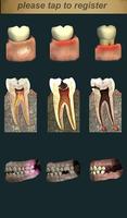 Dental Pain Lite