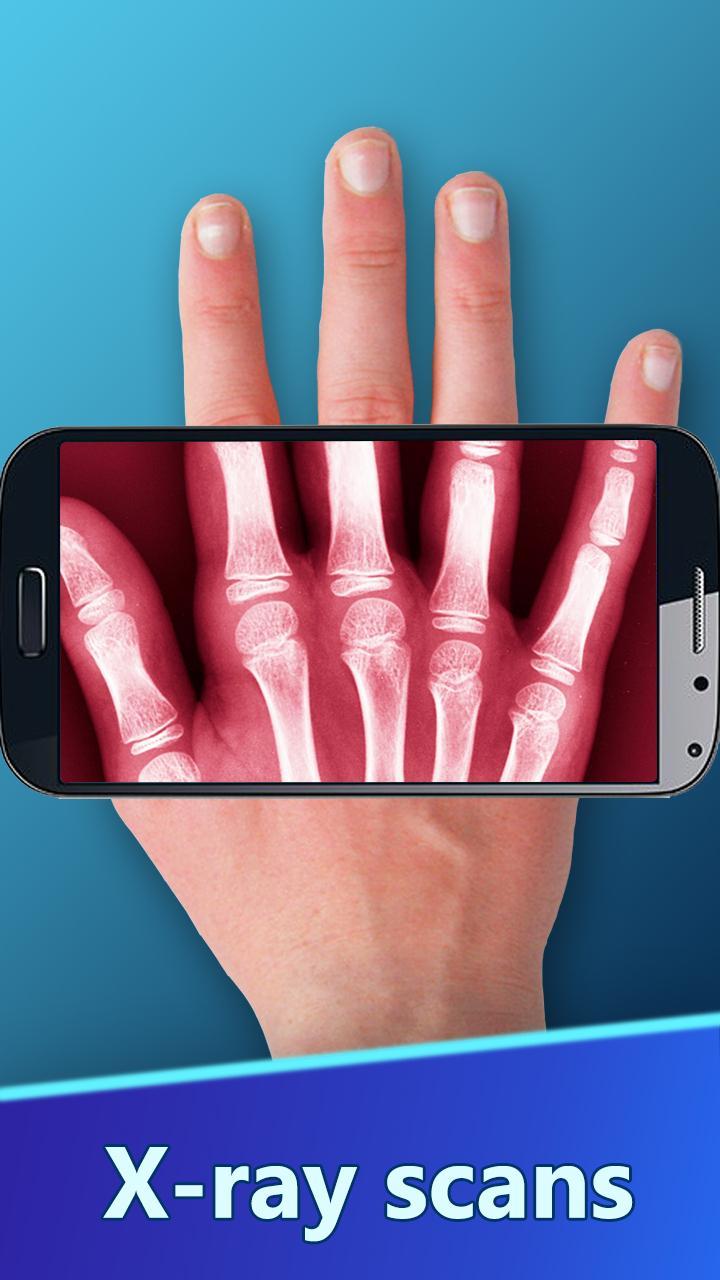 The X-Ray Scanner